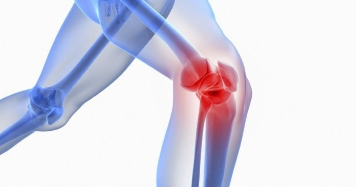 Acupuncture For Arthritis & Joint Pain ATCM